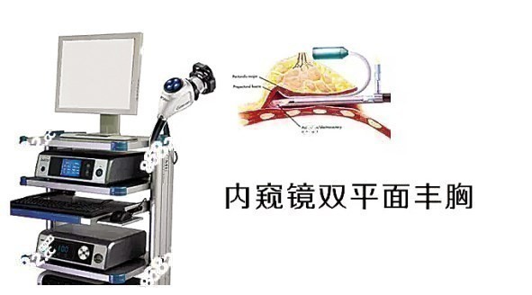 乳房重建做内窥镜双平面假体隆胸