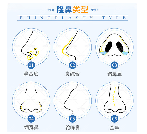 金华隆鼻排名前三医院名单推荐