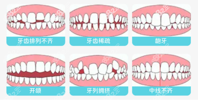 陇西舒美口腔可以做的牙齿矫正类型