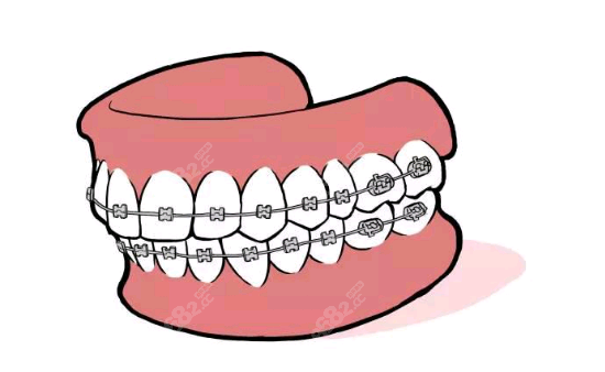 荆州牙齿矫正便宜，不贵哦