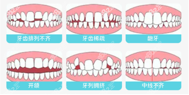 嘉峪关牙齿矫正价目表