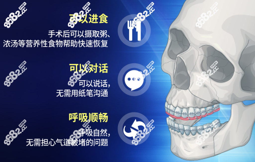 韩国正颌手术疗效