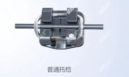 普通的金属托槽特点