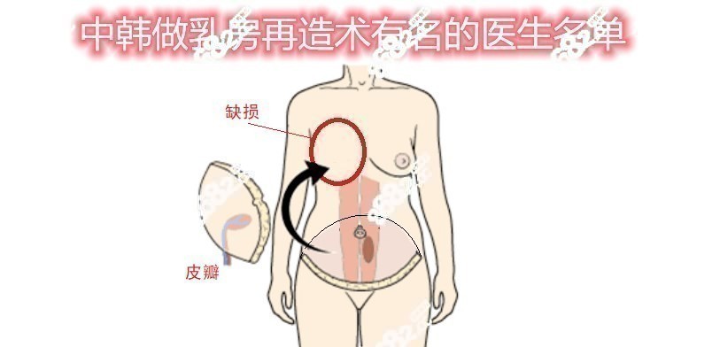 中韩做乳房再造术出名的医生名单