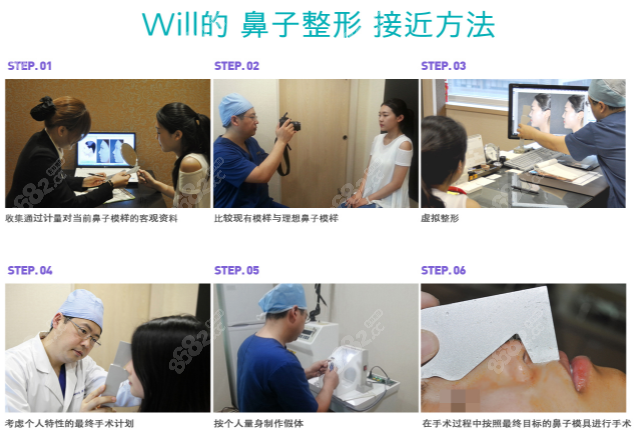 韩国will整形医院鼻整形过程