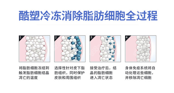 酷塑冷冻溶脂消除脂肪细胞全过程