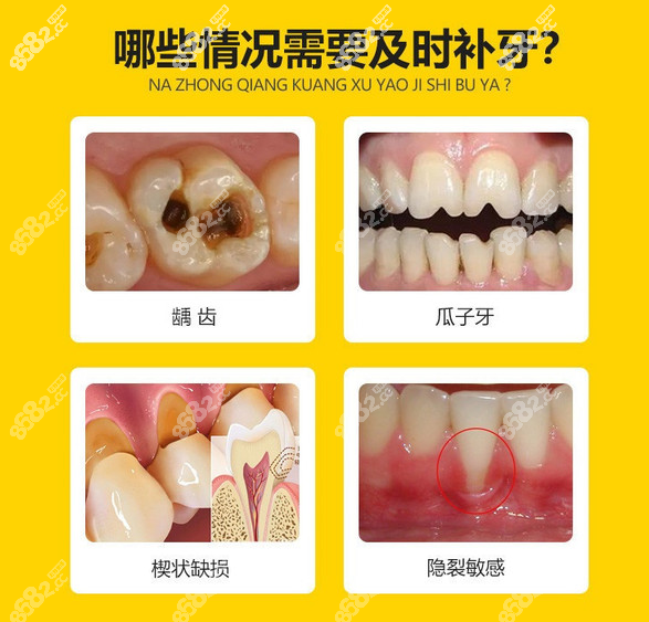 邛崃新桥口腔补牙收费标准
