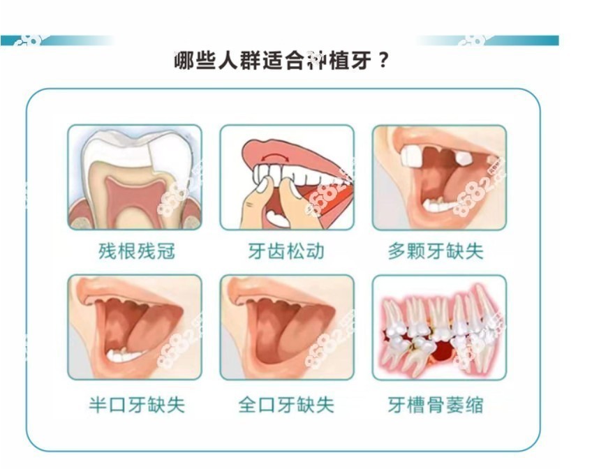无锡佳士洁口腔的种植牙过程