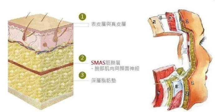 pst面部提升可以提拉到的面部组织层次