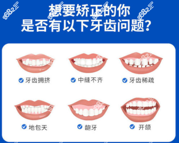 临安牙齿矫正费用