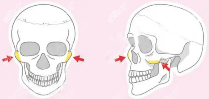 双鄂手术<span style=