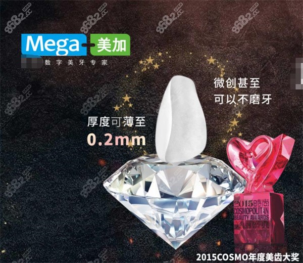 美加牙贴面