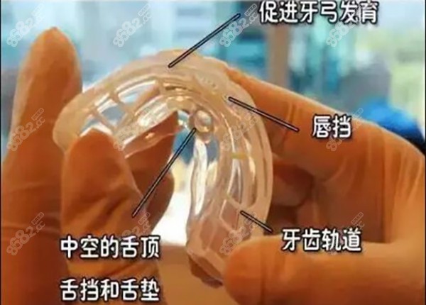 青岛儿童牙齿矫正比较好