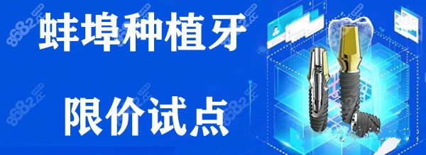 蚌埠种植牙试点都是国产的吗？