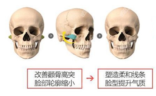 杭州高俊明改脸型技术好