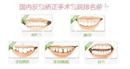 国内反颌矫正手术医院排名前十