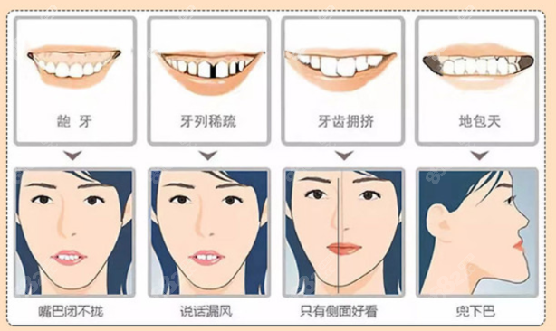 义乌世瑞口腔牙齿矫正价格表