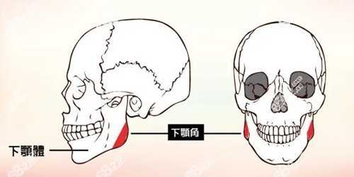 一般磨骨手术费用是多少钱