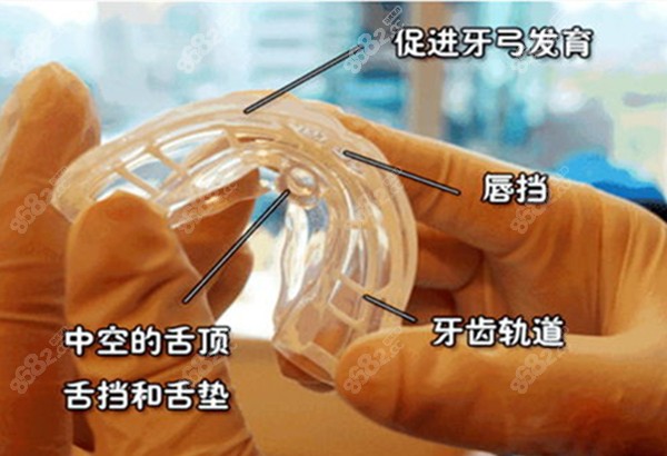 儿童早期干预矫正器的作用