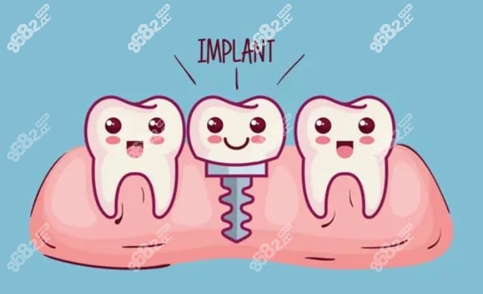 這是種植牙卡通圖 這是種植牙卡通圖