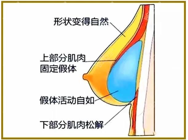 www.8682.cc郴州假体隆胸哪个医院好