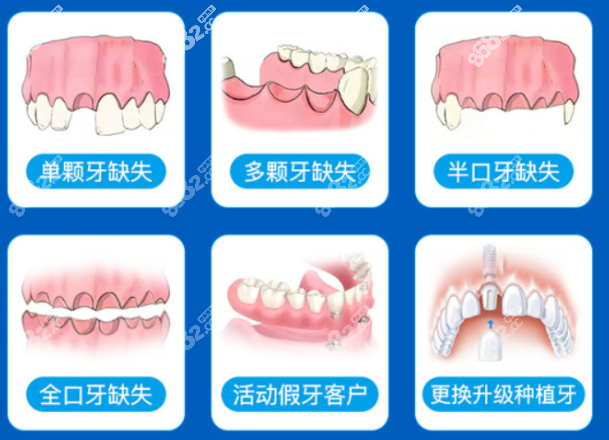 杭州<!--<i data=20240705-sp></i>-->口腔做种植牙怎么样