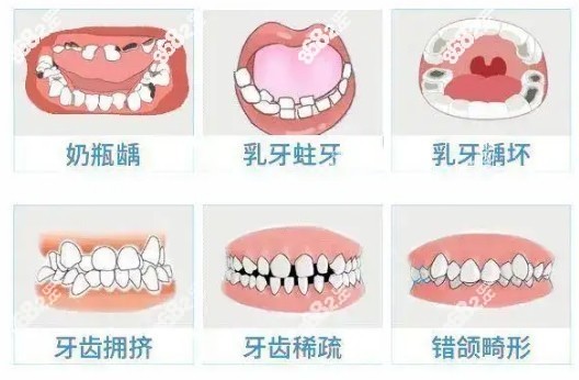 适合做牙齿矫正症状