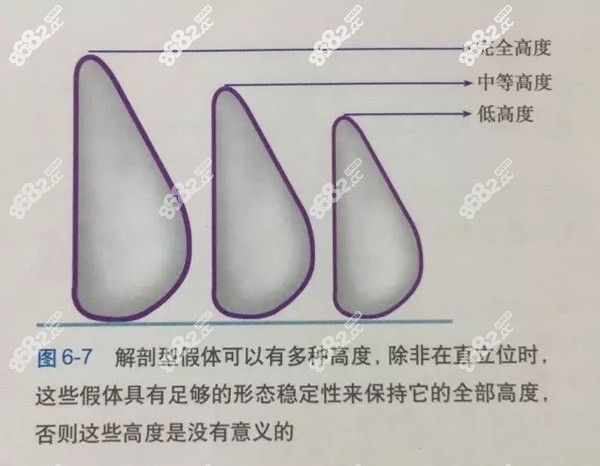 水滴形假体的不同突度