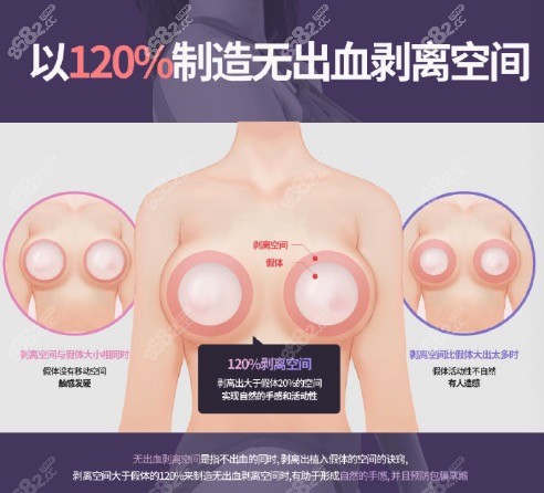 韩国TS整形外科医院做假体隆胸手术好不好