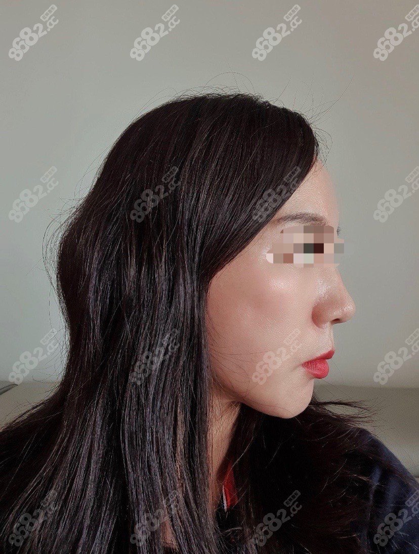 柳敏元拉皮真人图