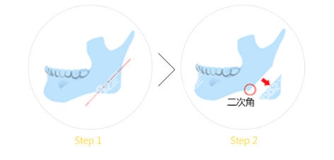 韓國(guó)珠兒麗輪廓做得好 韓國(guó)珠兒麗輪廓做得好