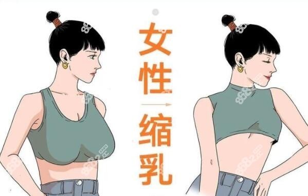 成都乳房缩小好的医院医生汇总