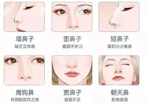 成都做鼻子出名的医生擅长隆鼻的类型.jpg