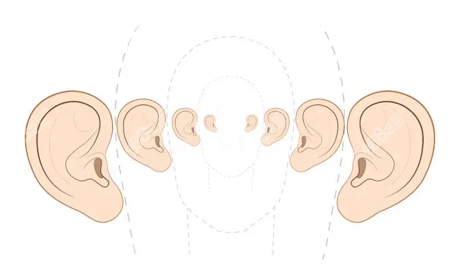 耳再造手术适合年龄