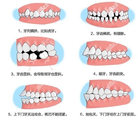 www.8682.cc<!--<i data=20240705-sp></i>-->口腔正畸费用