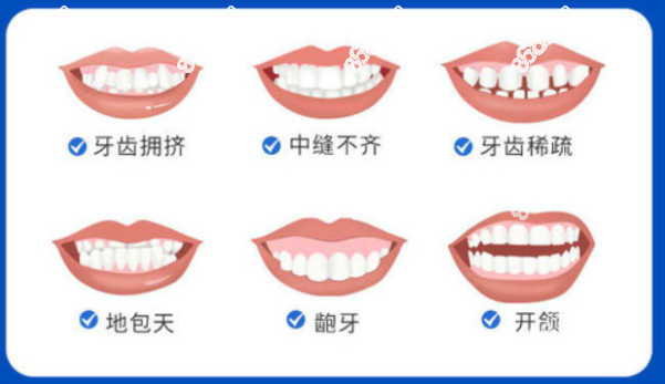 杭州瑞创口腔做牙齿矫正收费价格不贵