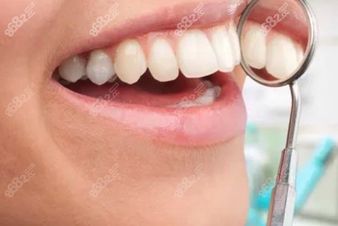 種植體如何選擇?越貴的種植體就越好嗎?