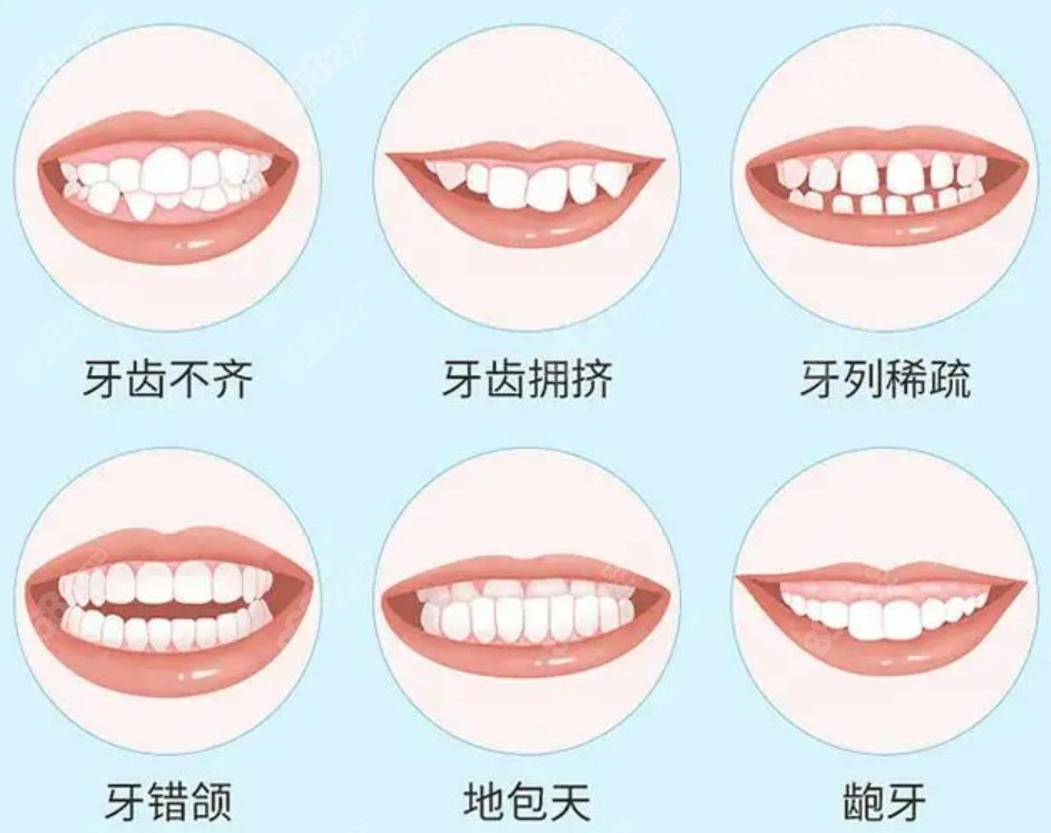 天水矫正牙齿哪个医院比较好