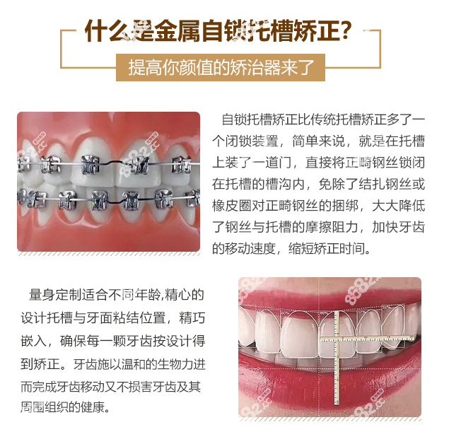 巴中矫正牙齿大概多少钱