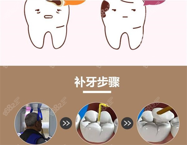 补牙的过程