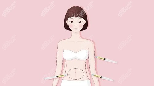 黄金微雕吸脂