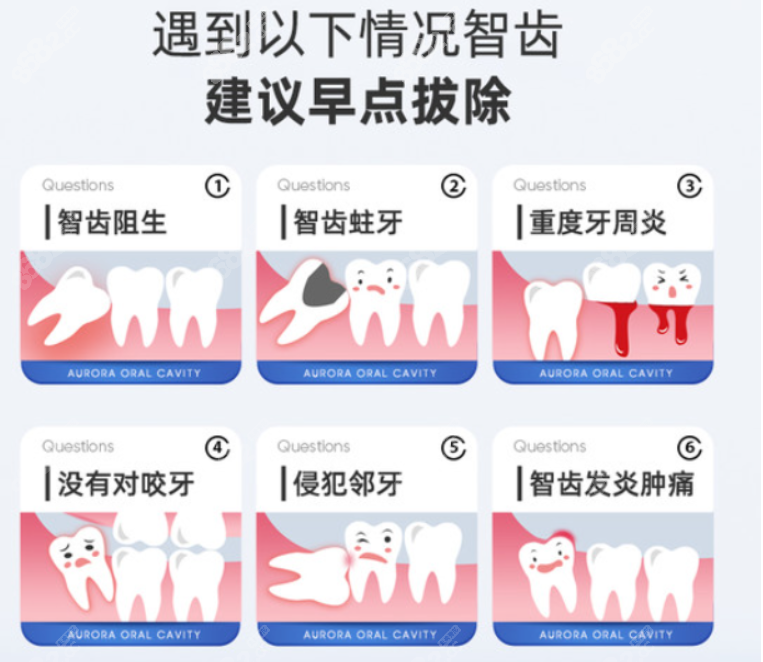 桂林源数口腔拔智齿的类型