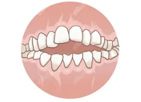 开颌手术对<span style=