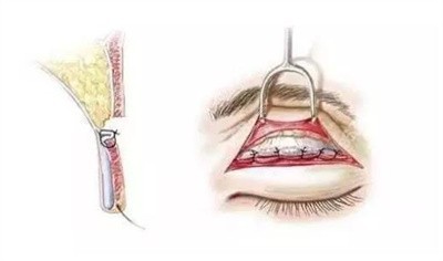 2022年下半年南宁东方整形收费标准2 2022年下半年南宁东方整形收费标准2