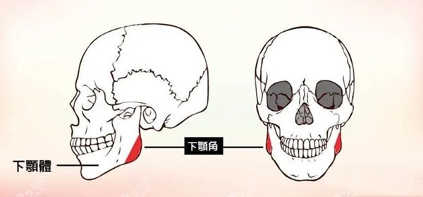 银川磨骨医院华美/丽都做下颌角,颧骨技术好,价格30000起,颌面对比照-