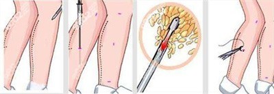 2022年下半年南宁东方整形收费标准3 2022年下半年南宁东方整形收费标准3