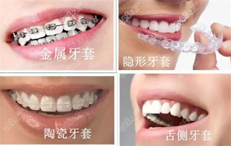 开颌矫正脸型会变好看吗？