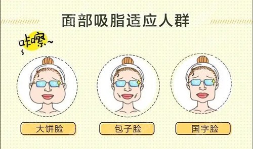 面部吸脂
