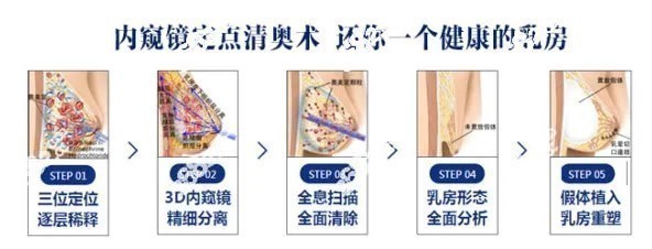 全息6維層離清奧術(shù)怎么樣