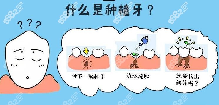 什么是人工种植牙